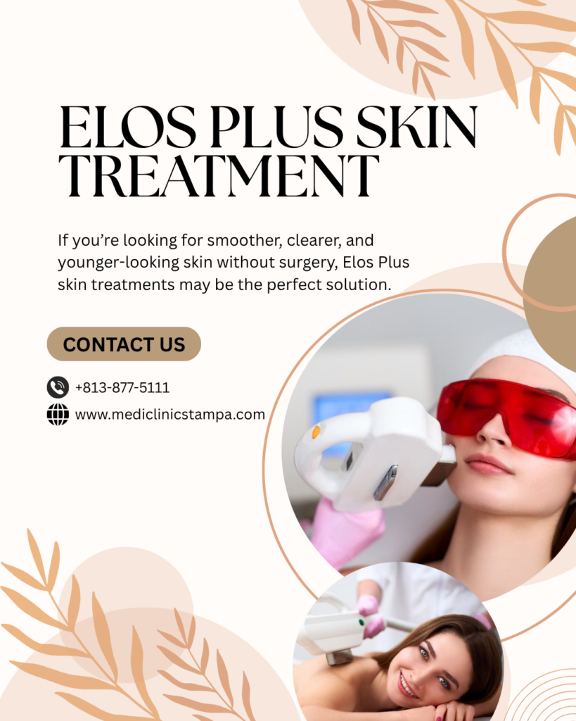 Elos Plus Skin Treatment